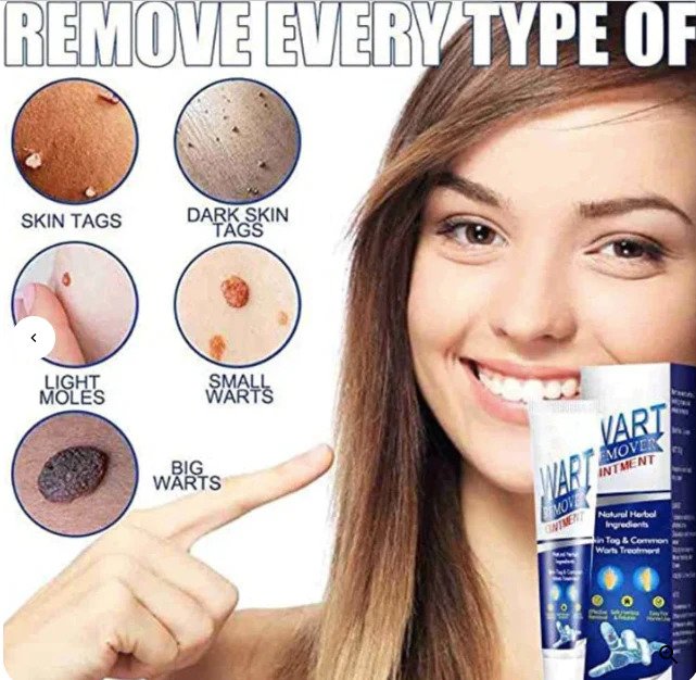 Wart Remover ( Buy 1 Get 1 Free )