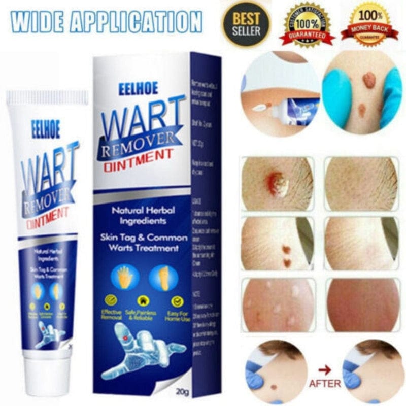 Wart Remover Ice Cream Mask Scrollstreet